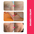 DepiLine™ - Depilador Egípcio com Linha 100% Elétrico Recarga USB (Kit Completo)