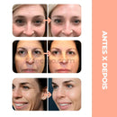 GlowUp® - Massageador Facial Rejuvenescedor Elimina Rugas e Papadas