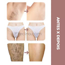 Crystal® - Depilador Esfoliante Indolor Anti-Foliculite (Compre 1, Leve 2)