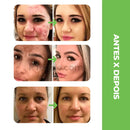 Moisture® - Base À Prova D'Água Remove Todas Manchas e Expressões (Compre 1, Leve 2)